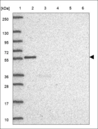 Anti-LRP11 Antibody