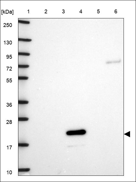 Anti-RBM38 Antibody