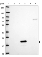 Anti-RBM38 Antibody