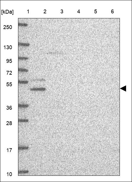 Anti-ZNF587B Antibody