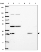 Anti-UBFD1 Antibody