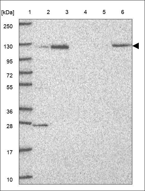 Anti-WASHC5 Antibody
