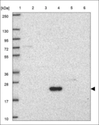 Anti-NKX6-2 Antibody