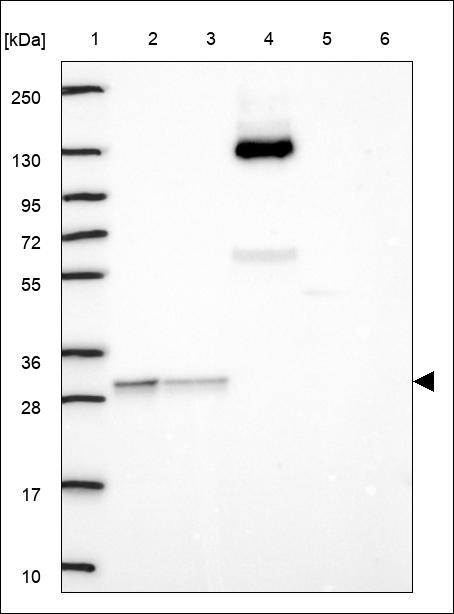Anti-OVCA2 Antibody