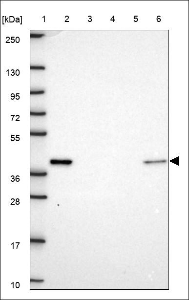 Anti-SDSL Antibody