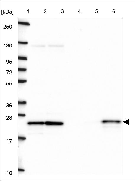 Anti-CBFB Antibody