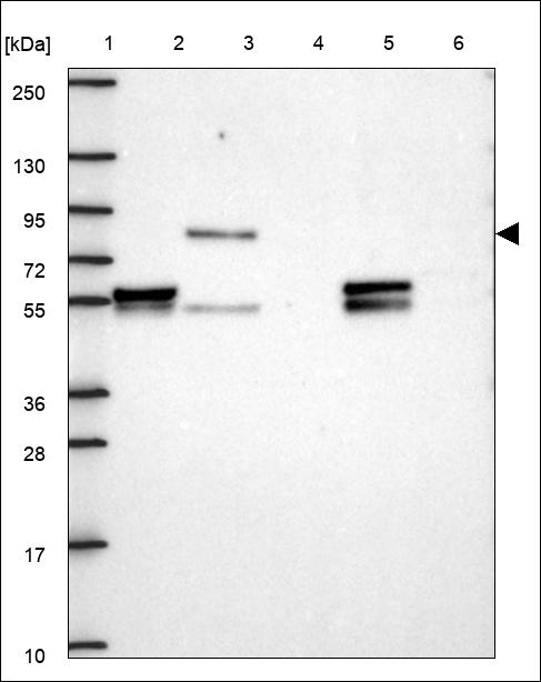 Anti-POMT1 Antibody