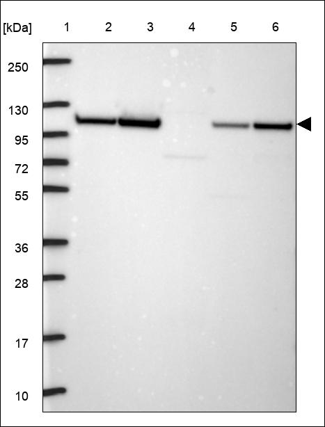 Anti-ACTN1 Antibody