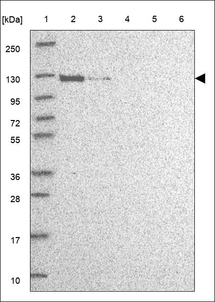 Anti-EPHA5 Antibody