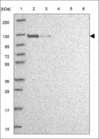 Anti-EPHA5 Antibody
