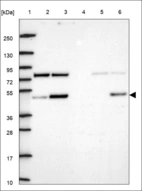 Anti-PLEKHA2 Antibody