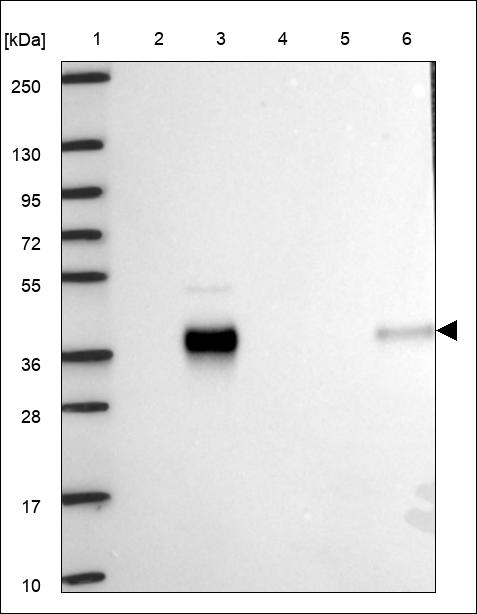 Anti-PDLIM4 Antibody