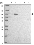 Anti-ARNT Antibody