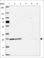Anti-N6AMT1 Antibody