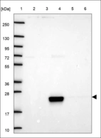 Anti-C8G Antibody