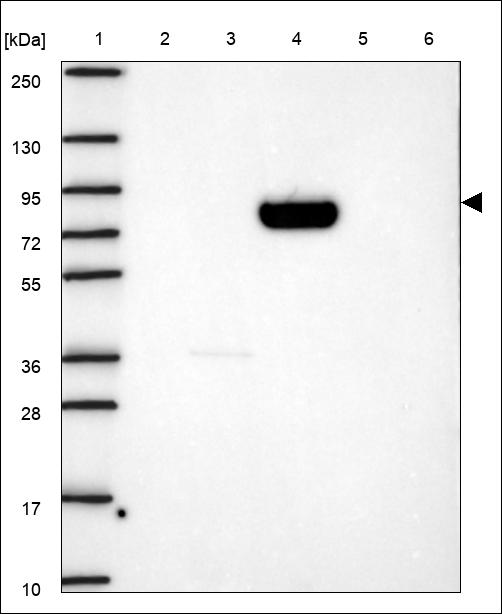 Anti-NAALADL1 Antibody