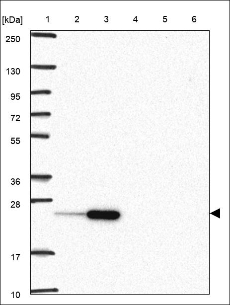 Anti-RPL18 Antibody