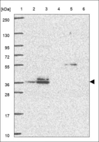 Anti-AURKB Antibody
