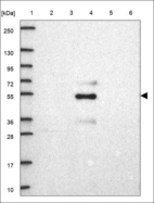 Anti-CHRNA9 Antibody