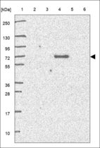 Anti-ZCCHC4 Antibody