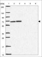 Anti-CCT3 Antibody