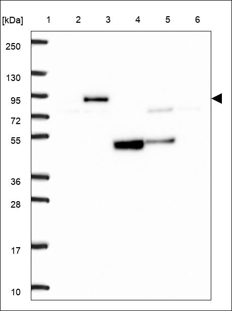Anti-ABCG8 Antibody