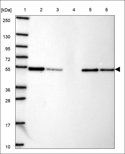 Anti-SERPINB7 Antibody