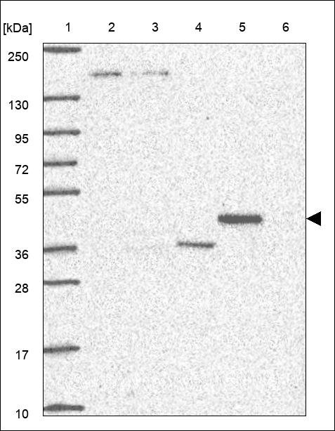 Anti-LPCAT3 Antibody
