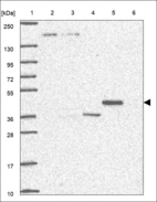 Anti-LPCAT3 Antibody