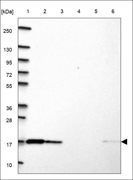 Anti-SRP14 Antibody