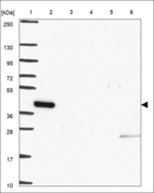 Anti-ORC4 Antibody