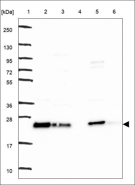 Anti-UBE2E1 Antibody