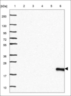 Anti-DPT Antibody