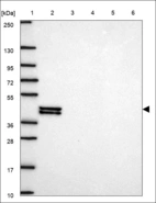 Anti-OAS1 Antibody