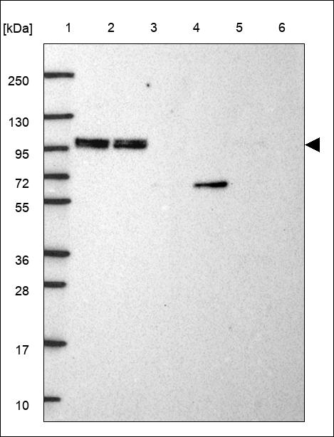 Anti-UBTF Antibody