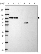 Anti-UBTF Antibody