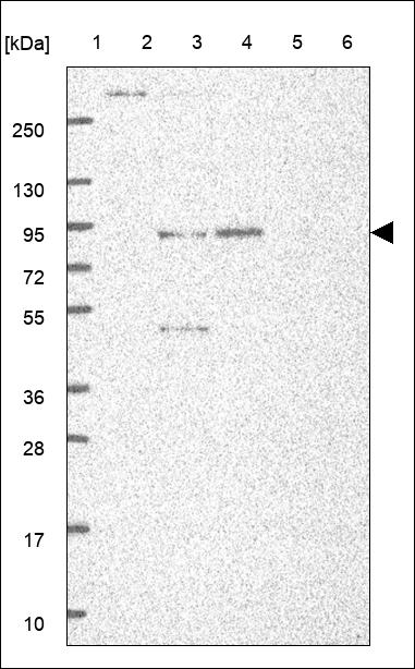Anti-KLKB1 Antibody