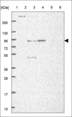 Anti-KLKB1 Antibody