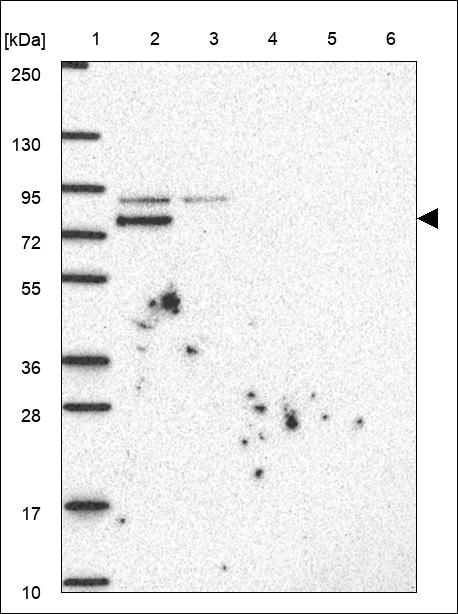 Anti-ZDHHC8 Antibody