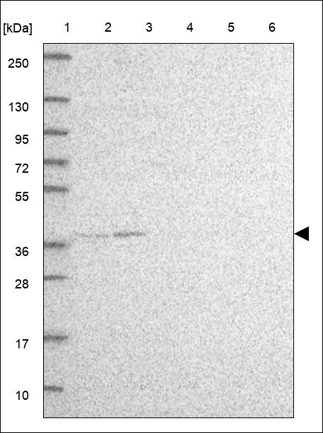 Anti-CDK10 Antibody