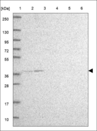 Anti-CDK10 Antibody