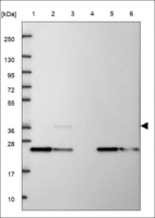 Anti-GNB2 Antibody