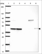 Anti-PSMD13 Antibody