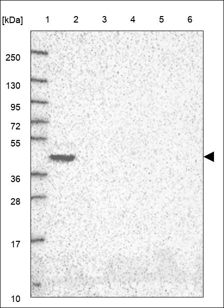 Anti-OGFOD3 Antibody