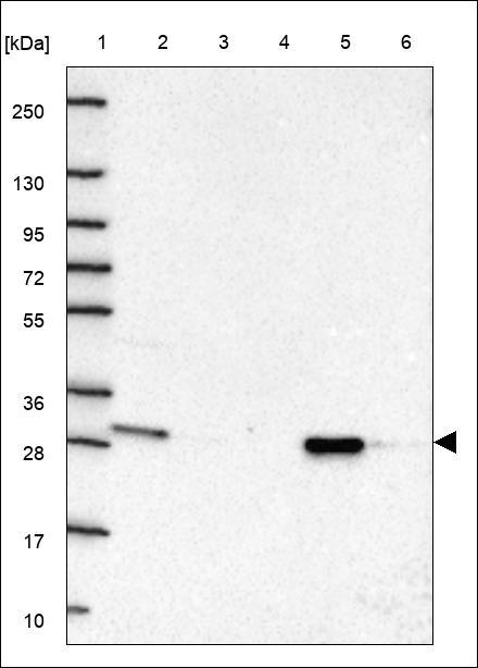 Anti-AUH Antibody