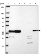 Anti-GTF2H3 Antibody