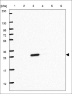 Anti-APCS Antibody