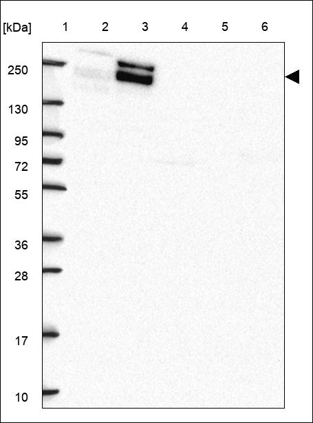 Anti-CRYBG1 Antibody