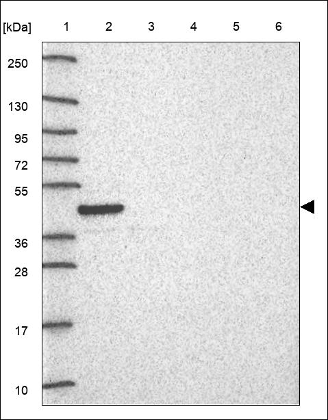 Anti-PPM1H Antibody