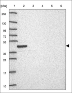 Anti-PPM1H Antibody